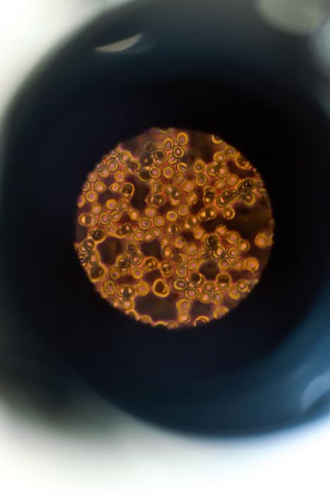 Cells through microscope