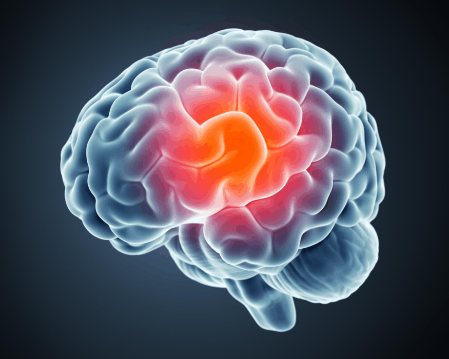 Brain picture with orange center